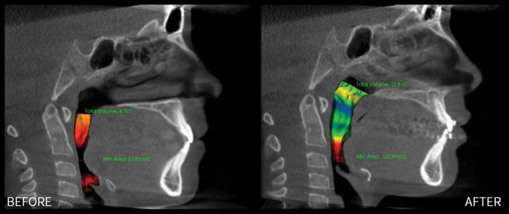 Airway Orthodontics in Darien, IL