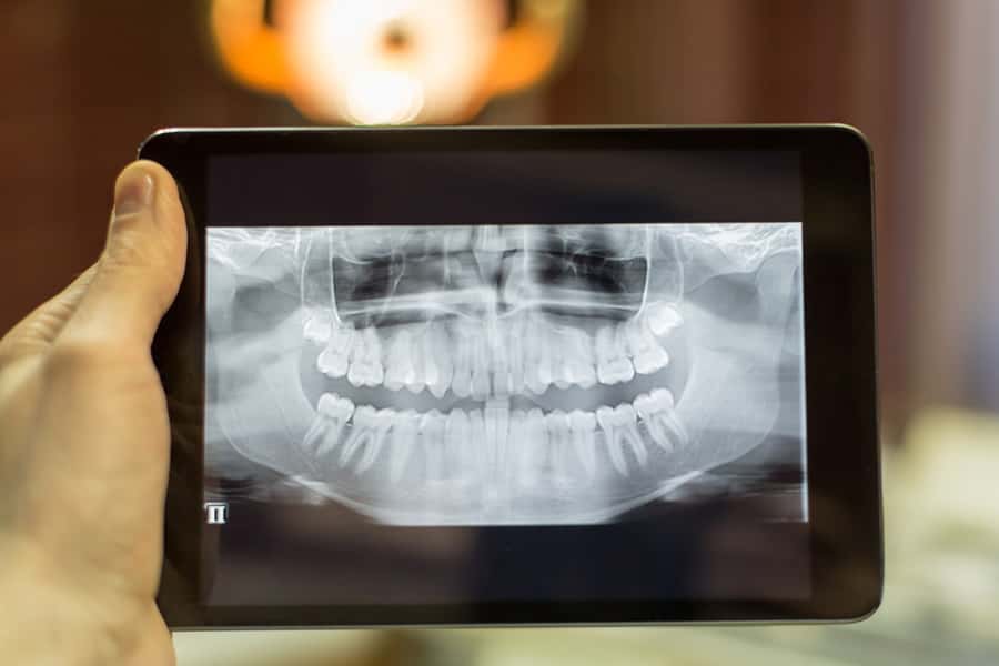 Digital Radiography in Darien, IL